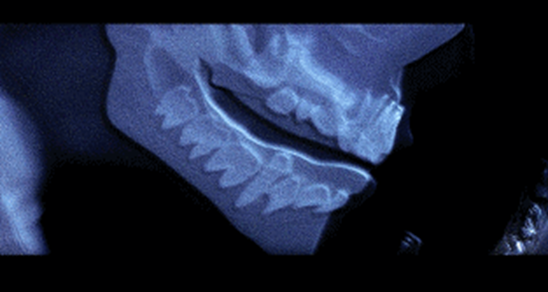 初恋小白鼠_初恋小白鼠1234_初恋小白鼠第33话正版